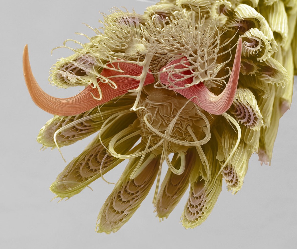 Name:  A mosquitos foot at 800X magnification.jpg
Views: 1291
Size:  216.9 KB